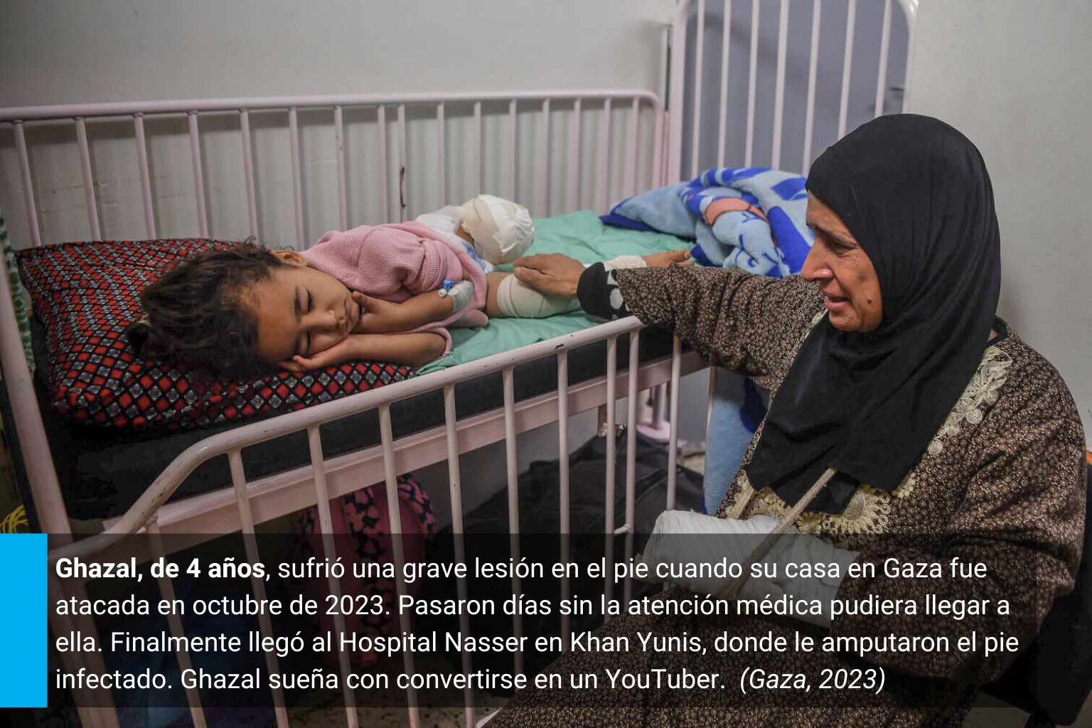Ghazal de 4 años se encuentra en el hospital luego de haber sufrido la amputación de su pierna tras bombardeos cercanos a su casa en octubre de 2023 en Gaza