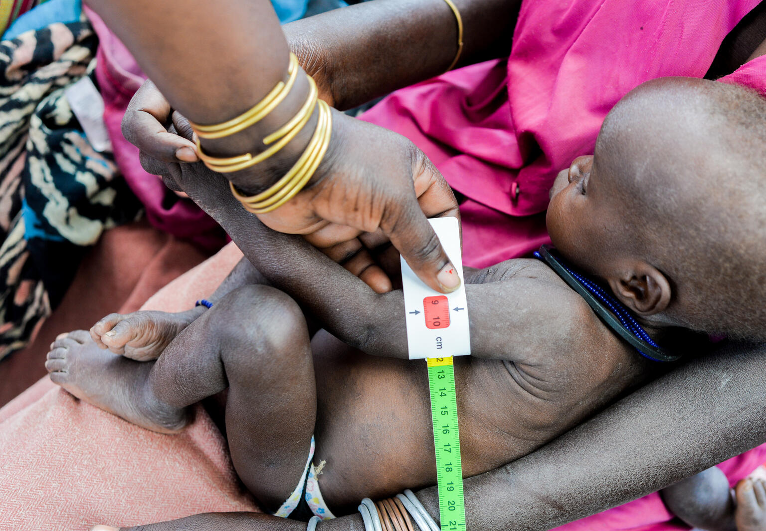 Pulkol Aduku, de un año de edad, se somete a un examen nutricional en el Centro de Salud III de Loputuk en el distrito de Moroto, subregión de Karamoja. Se confirma que está gravemente desnutrido.