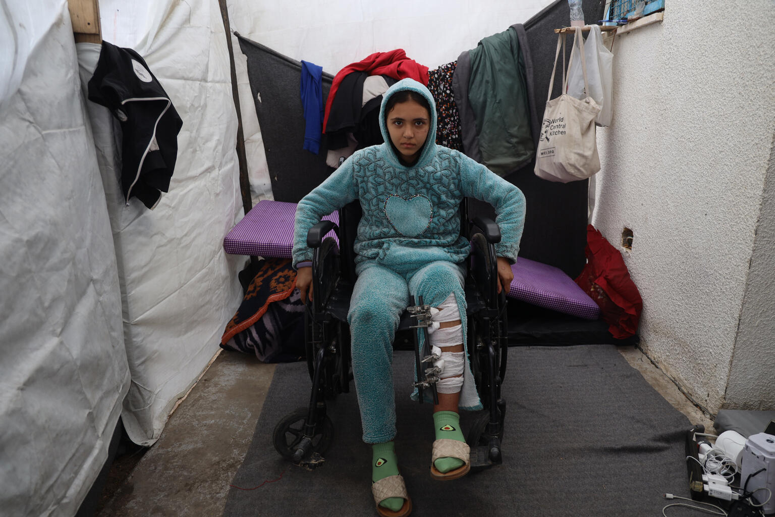 11 de enero de 2024, en un centro de acogida situado en la zona industrial de Khan Yunis, en el sur de Gaza, Mays, de 13 años, sentada en una silla de ruedas debido a una lesión en la pierna.